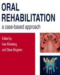 Iven Klineberg - Oral Rehabilitation