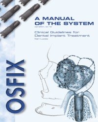 Kari Luotio - Clinical Guidelines for Dental Implant Treatment