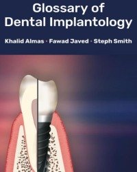 Khalid Almas - Glossary of Dental Implantology (2018)