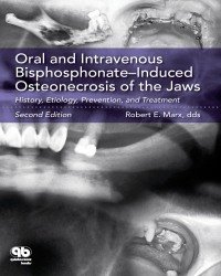 Robert E. Marx - Oral and Intravenous Bisphosphonate