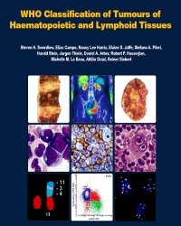 Steven H. Swerdlow - WHO Classification of Tumours of Haematopoietic and Lymphoid Tissues