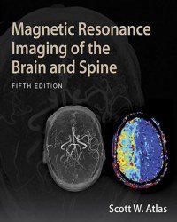 Scott W. Atlas - Magnetic Resonance Imaging of the Brain and Spine (5th edition, 2017)