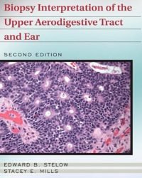 Edward B. Stelow - Biopsy Interpretation of the Upper Aerodigestive Tract and Ear (Second edition)