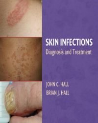 John C. Hall - Skin Infections