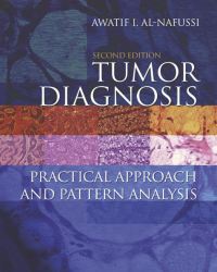 Awatif Al-Nafussi - Tumor Diagnosis (Second edition)
