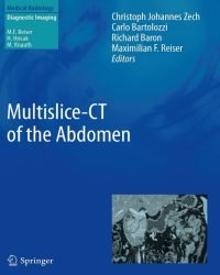Christoph Johannes Zech - Multislice-CT of the Abdomen