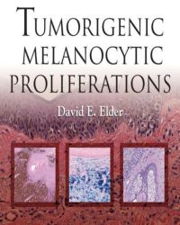 David E. Elder - Tumorigenic Melanocytic Proliferations