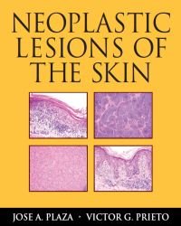 Jose Plaza - Neoplastic Lesions of the Skin
