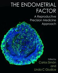 Carlos Simon - The Endometrial Factor