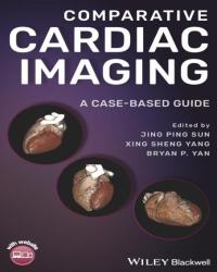 Jing Ping Sun - Comparative Cardiac Imaging