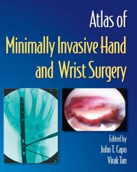 John T. Capo - Atlas of Minimally Invasive Hand and Wrist Surgery