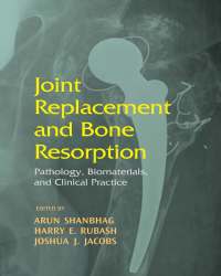 Arun Shanbhag - Joint Replacement and Bone Resorption