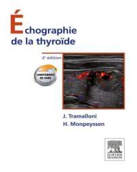 Jean Tramalloni - Echographie de la Thyroide (Французский язык)