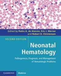 Pedro de Alarcon - Neonatal Hematology