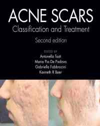 Antonella Tosti - Acne Scars (2019)