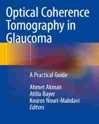 Ahmet Akman - Optical Coherence Tomography in Glaucoma