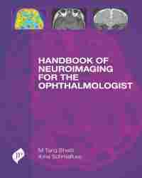 M. Tariq Bhatti - Handbook of Neuroimaging for the Ophthalmologist