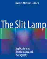 Marcus Matthias Gellrich - The Slit Lamp. Applications for Biomicroscopy and Videography (Plus Video)
