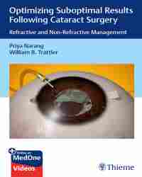 Priya Narang - Optimizing Suboptimal Results Following Cataract Surgery (2019)