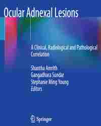 Shantha Amrith - Ocular Adnexal Lesions