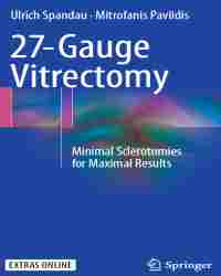 Ulrich Spandau - 27-Gauge Vitrectomy