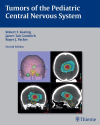 Robert F. Keating - Tumors of the pediatric central nervous system