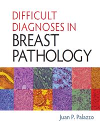 Juan P. Palazzo - Difficult Diagnoses in Breast Pathology