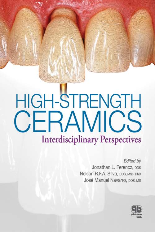 Jonathan l. ferencz high strength ceramics