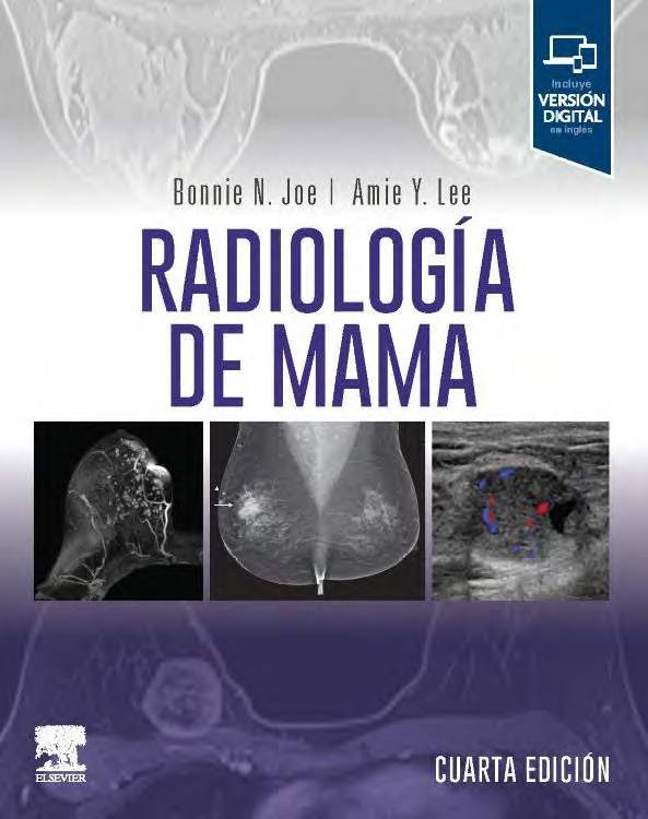 Bonnie n. joe radiologia de mama (испанский язык)