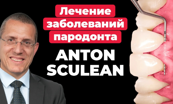 Антон скулеан лечение заболеваний пародонта
