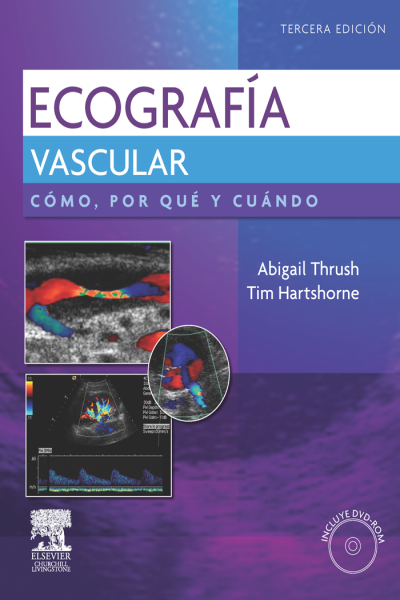 Abigail thrush ecografia vascular (испанский язык)