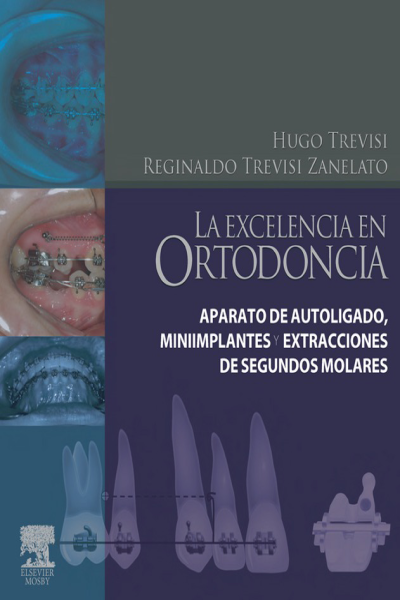 Hugo trevisi la excelencia en ortodoncia (испанский язык)