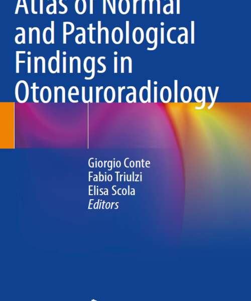 Atlas of normal and pathological findings in otoneuroradiology