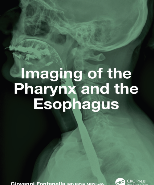 Giovanni fontanella imaging of the pharynx and the esophagus