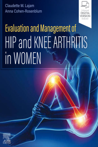 Evaluation and management of hip and knee arthritis in woman