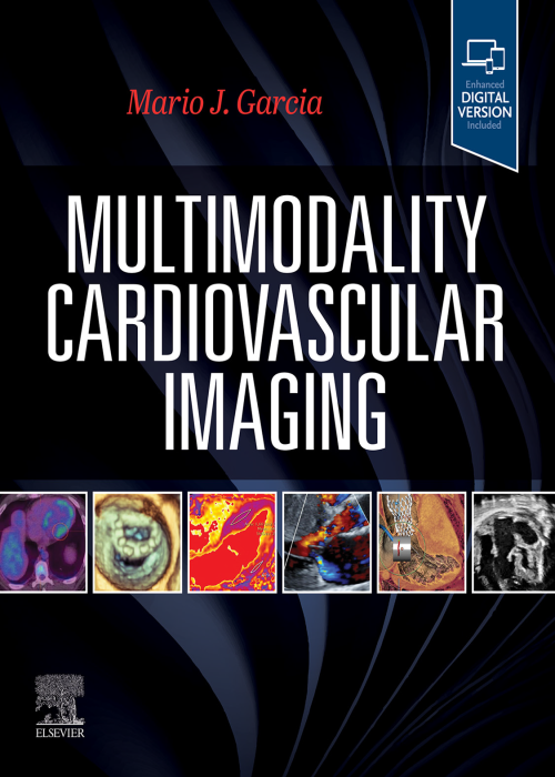 Mario j. garcia multimodality cardiovascular imaging