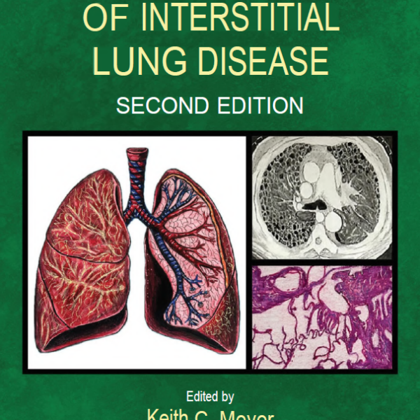 Clinical handbook of interstitial lung disease (second edition)