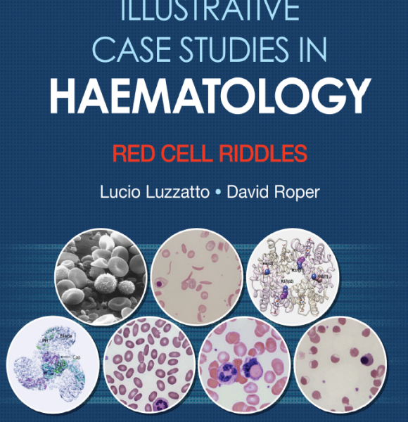 Illustrative case studies in haematology. red cell riddles