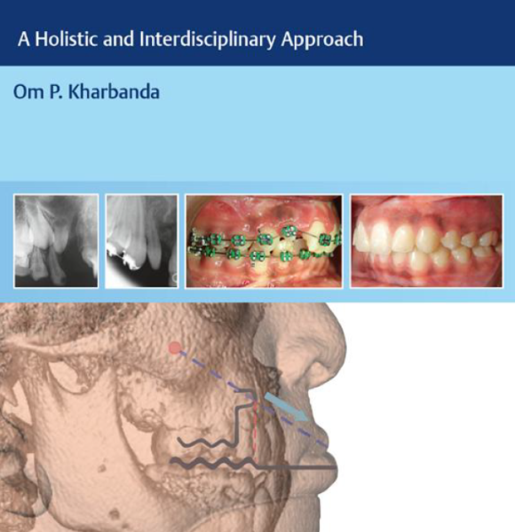 Om kharbanda cleft orthodontics